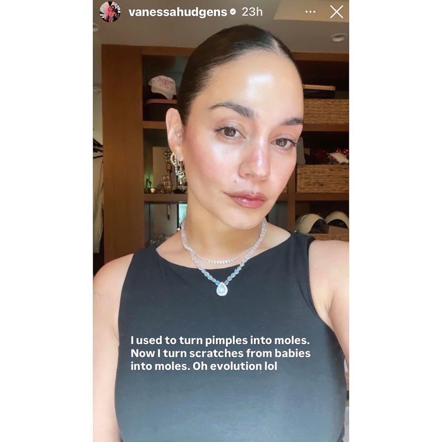 Vanessa Hudgens Their Skincare Issues Change as They Get Older Just Like Us